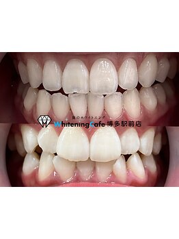 メンズにオススメのサロン