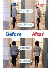 ハル鍼灸整骨院 池田院(HALU鍼灸整骨院)/産後骨盤矯正ビフォーアフター