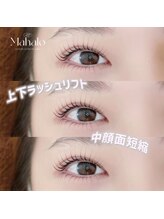 マハロ(Mahalo)/中顔面短縮したい方必須♪
