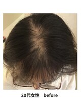 イーズ/リバイタ 梅田本店/【case8】２０代女性ビフォー