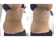 エムケーサロン(Mksalon)/40代後半/モニター様