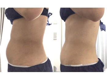 エムケーサロン(Mksalon)/40代後半/モニター様