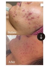 マルサンカクシカク(○△□)/