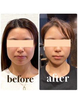 クリーム 京都店(Cream)/小顔さんも、この通り