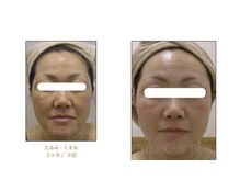 サロンド ボーテ ノンノ(SALON DE BEAUTE NONNO)の雰囲気(【シャルムボー化粧品取扱店】肌老化!あきらめないで!大丈夫!)