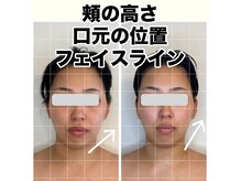 リル(LIL)の雰囲気(BeforeAfter)