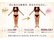 ソエルテ(soerute)の雰囲気（【漢方×痩身マシン】痩身／小顔／韓国肌/リンパマッサージ/痩せ）