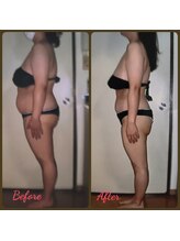 ダイエットルーム リ ボーヌ(Re Bornu)/・40代　全身半身メディセル32回