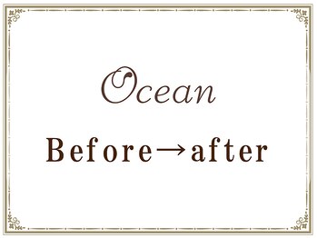 オーシャン(Ocean)/小顔矯正・美容矯正の効果