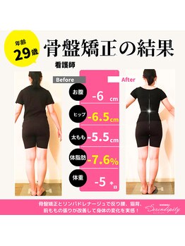 セレンディピティ 緑店(Serendipity)/２９歳　骨盤ダイエットの結果