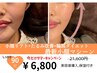 サマーキャンペーン/¥21,600→¥6,800【小顔リフト,輪郭ダイエット】小顔