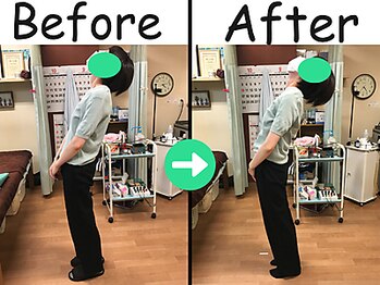 杉本接骨鍼灸院/坐骨の痛み・神経が原因