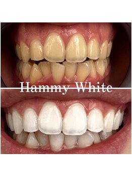 ハミーホワイト(Hammy White)/男性にも人気!