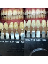 トウキョウスワーズ 池袋店(TOKYO SWRS)/#ホワイトニング #池袋 #渋谷