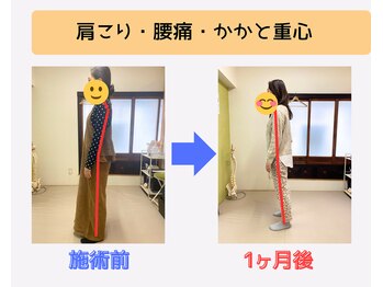 戸田はりきゅう整骨院/足指整体Before・After