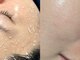ベリンダ(BELINDA)の写真/SNSで話題！本厚木エリア初導入★美容大国・韓国の本格派化粧品【セルマン】角質を整え肌本来の艶肌に♪