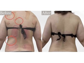 プリマルーチェ/プレミアム上半身プログラム