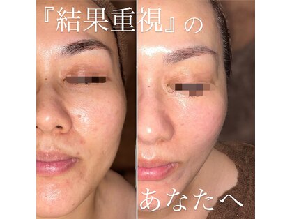 ロゼ ミニョン(Roser mignon)の写真