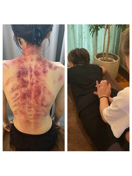 エミール(EMIIR)/グアサー、推拿整体