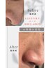 【毛穴毛穴とにかく毛穴☆】LED毛穴洗浄集中90分コース☆¥12,000