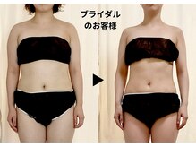 ディアメデル(Diamedel)/