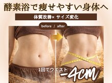 ソルニスデュオ(Solnis.-duo-)