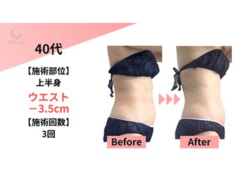 クレビア(Clevia)/Clevia-クレビア