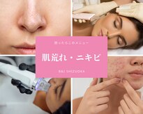 ビーアンドアイ シズオカテン レディース(B＆I SHIZUOKA)