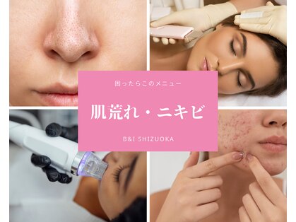 ビーアンドアイ シズオカテン レディース(B＆I SHIZUOKA)の写真