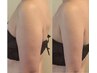 【本気でダイエットをお考えの方】無料カウンセリング