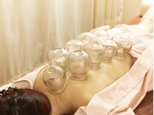 桂林堂鍼灸治療院 日吉/★吸い玉★