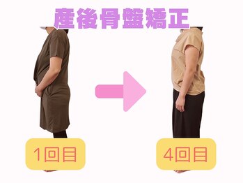 ライトワーク 西新宿店/産後骨盤矯正