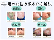 巻き爪補正店 横浜駅前店