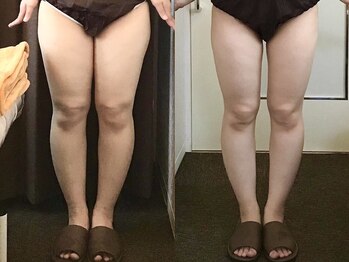 美容整体 ウェリナ 蟹江院/.【ダイエットbefore→after】
