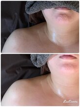 ファーノ/肩首すっきり小顔へ