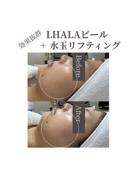 フォルディオ(FORDIO)/ララピールx水玉リフティング