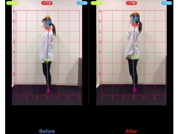 ケアルーム 綱島(CARE room)/施術効果写真☆（before after）