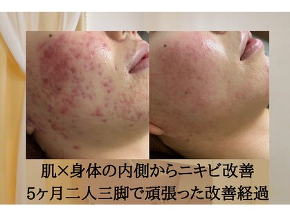 アエオボンヌール(A.E.O BONHEUR)の写真