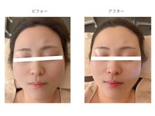 ケンジョビューティーサロン(Kenjo &nbsp;Beauty Salon)の雰囲気（ララピ－ル　ビフォーアフター）