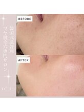 イチ(ichi)/水光肌フェイスワックス/wax