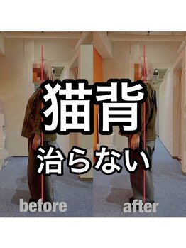 カワル整体 上通り院/猫背、解消しない人。
