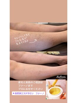 ファーノ/剃らずに、足の肌をキレイに