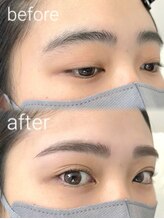 ビメ 中央林間(BEME)/before ・after 