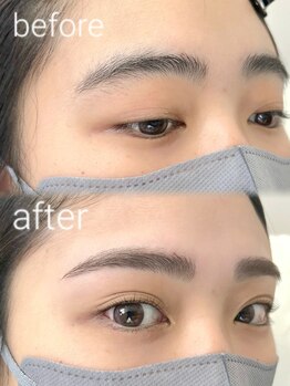 ビメ 中央林間(BEME)/before ・after