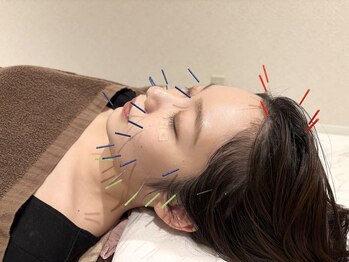 クマノミ美容鍼灸 銀座院(KUMANOMI美容鍼灸)/リフトUP！ブルドック顔解消！