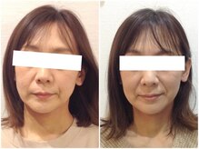 美容整体ウェリナ 名駅院/小顔矯正/骨盤矯正/美脚サロン