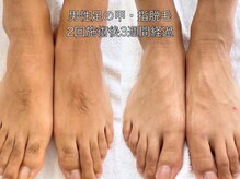 エクレ 柏店(EKURE)/メンズ脚脱毛