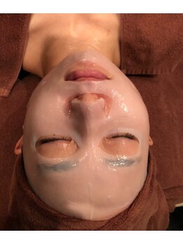 レナンセラ バイ カトレアグループ(Renanthera by カトレアGroup)/パックでこんなに変わるとは!