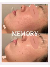 メモリー(MEMORY)/毛穴のないなめらかな肌に♪