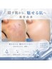 20日以内再来・顔ハーブピーリング剥離なし ヒト幹細胞導入¥12,000→¥10,000